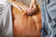 Physiotherapie Behandlung